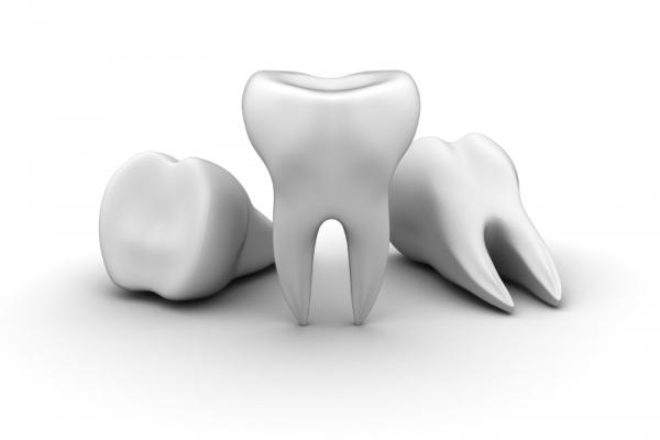 Bracing For Sale – Considerations For Dentists Selling Their Dental Practice